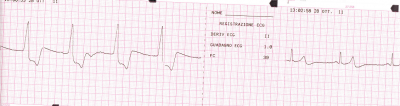 EKG.png